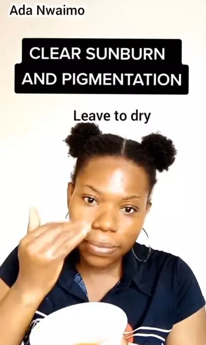 Trik mengatasi sunburn pada wajah pakai 1 jenis sayur Berbagai sumber