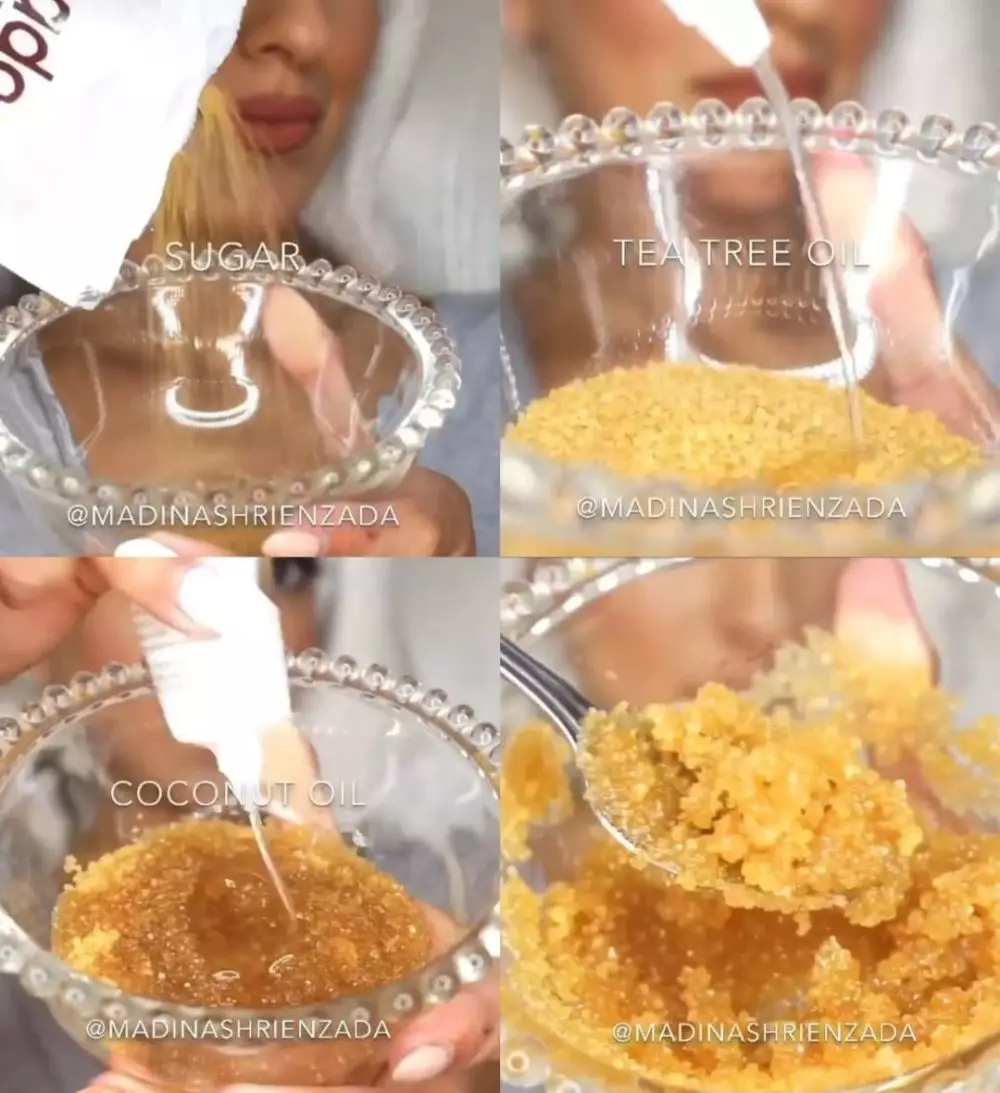 atasi ketombe dengan scrub © Instagram atasi ketombe dengan scrub © Instagram