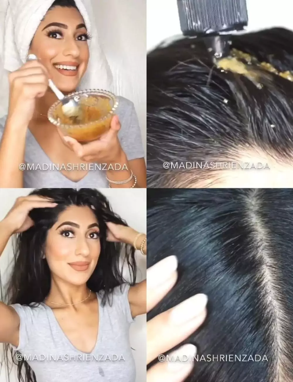 atasi ketombe dengan scrub © Instagram atasi ketombe dengan scrub © Instagram