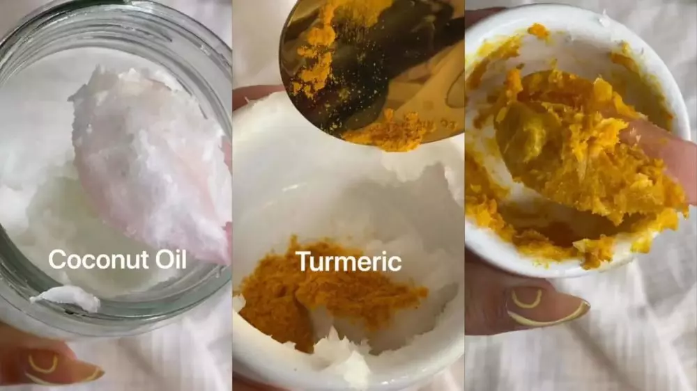 gigi putih mengkilat © Instagram gigi putih mengkilat © Instagram