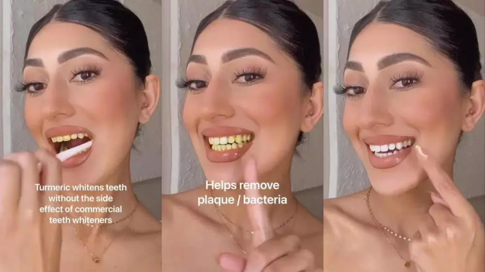 gigi putih mengkilat © Instagram gigi putih mengkilat © Instagram