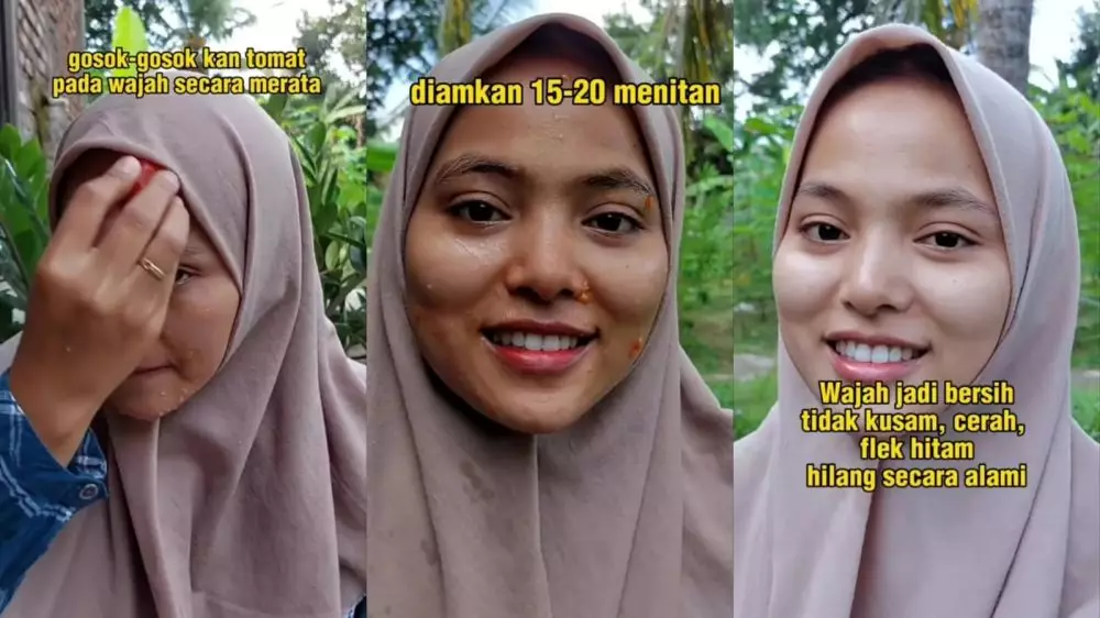 Flek hitam terhempas © Instagram Flek hitam terhempas © Instagram