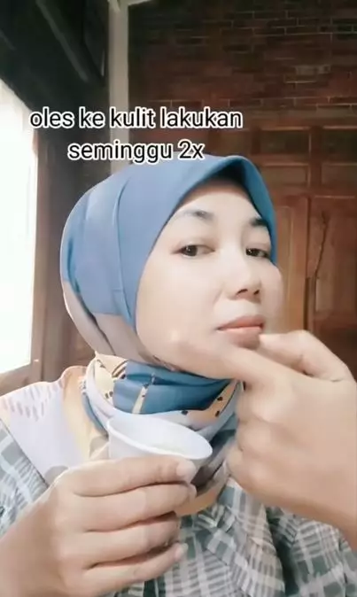 Cara mengatasi kerutan dan flek hitam pakai 1 jenis buah Berbagai sumber Cara mengatasi kerutan dan flek hitam pakai 1 jenis buah Berbagai sumber