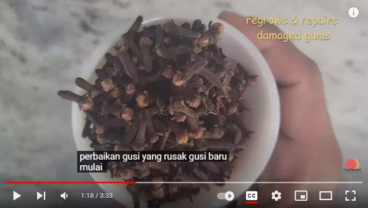 Cara membersihkan gusi menghitam dan hilangkan karang gigi berbagai sumber Cara membersihkan gusi menghitam dan hilangkan karang gigi berbagai sumber