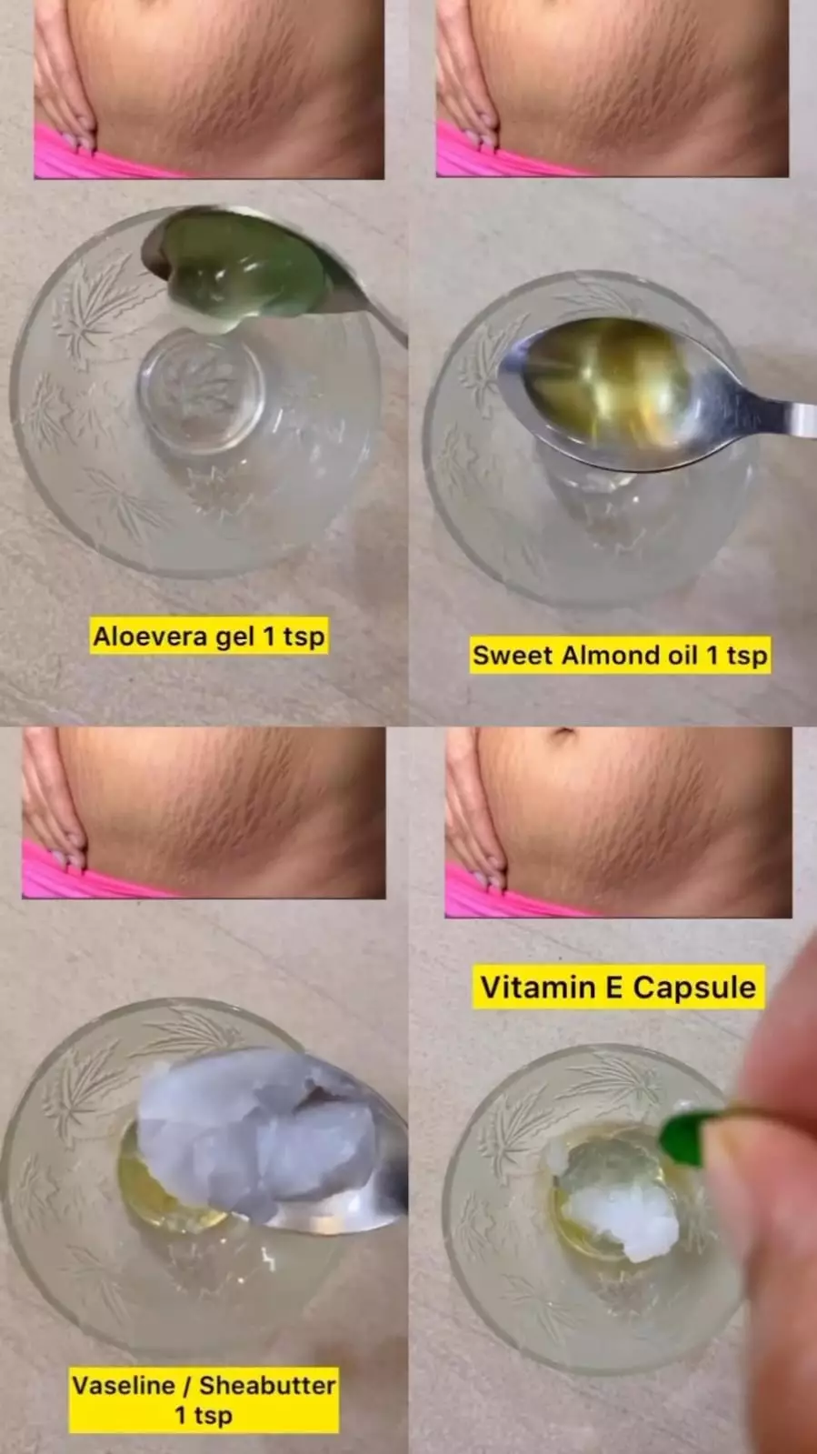 hilangkan stretch marks di badan © Instagram hilangkan stretch marks di badan © Instagram