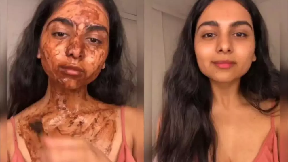 enyahkan hiperpigmentasi © Instagram