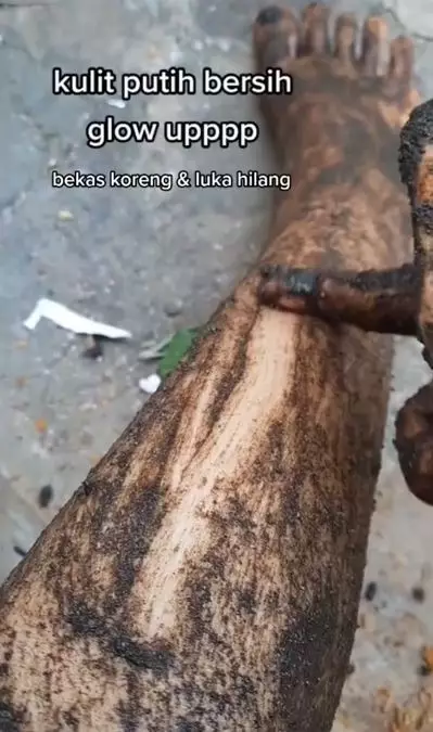 Trik menghilangkan bekas luka pakai scrub dari 1 bahan minuman Berbagai sumber