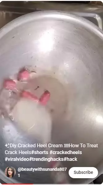 trik atasi tumit pecah-pecah hanya pakai 4 bahan alami berbagai sumber trik atasi tumit pecah-pecah hanya pakai 4 bahan alami berbagai sumber