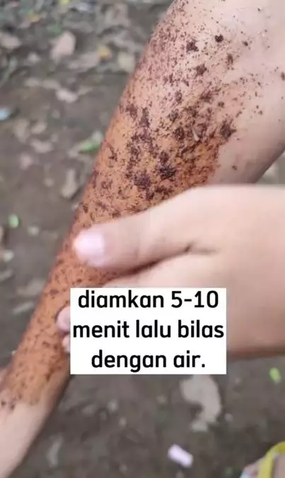 Trik memutihkan kulit belang pakai 2 bahan alami Berbagai sumber