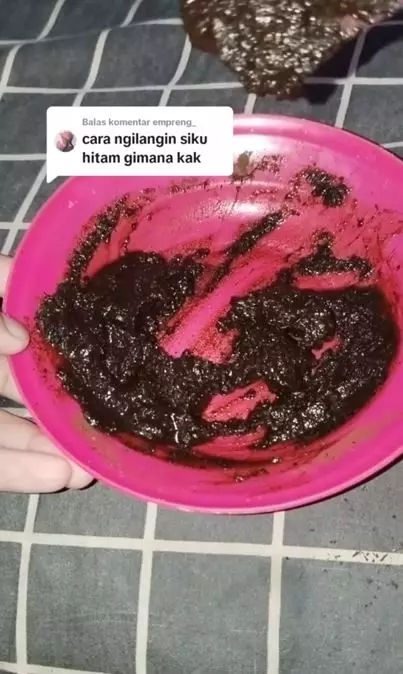 Cara memutihkan siku hitam agar warna kulit lebih cerah merata Berbagai sumber Cara memutihkan siku hitam agar warna kulit lebih cerah merata Berbagai sumber