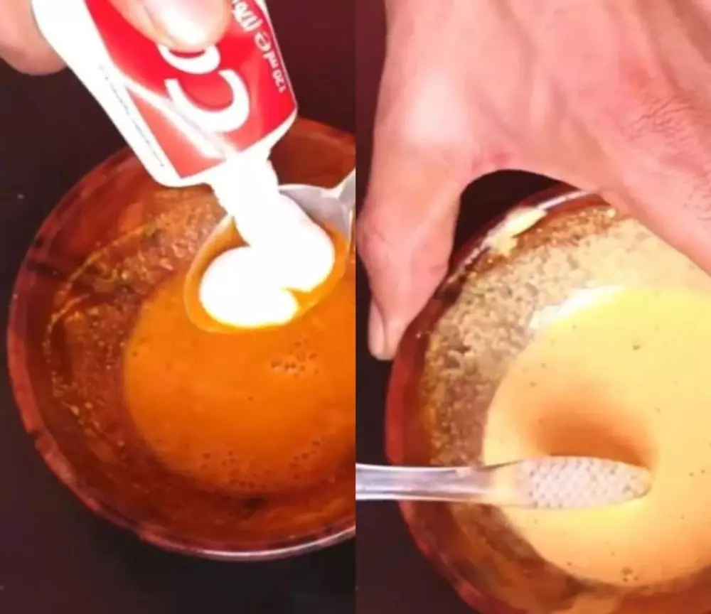 bersihkan plak membandel © Instagram