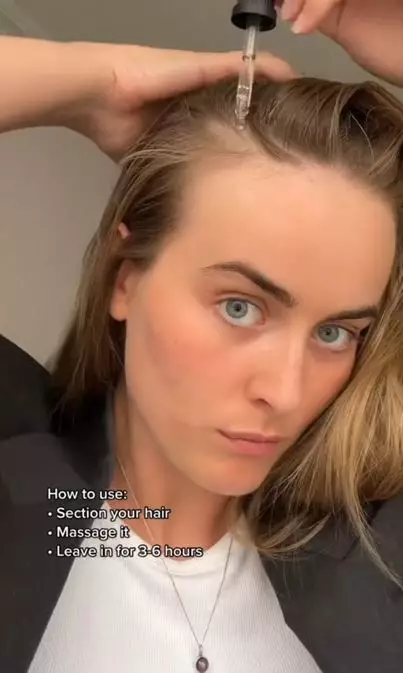 Trik mencegah rambut rontok pakai 3 jenis minyak Berbagai sumber