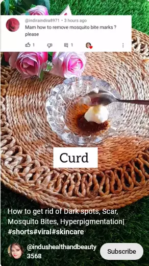 begini trik atasi bekas gigitan nyamuk berbagai sumber