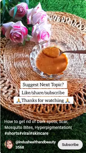 begini trik atasi bekas gigitan nyamuk berbagai sumber