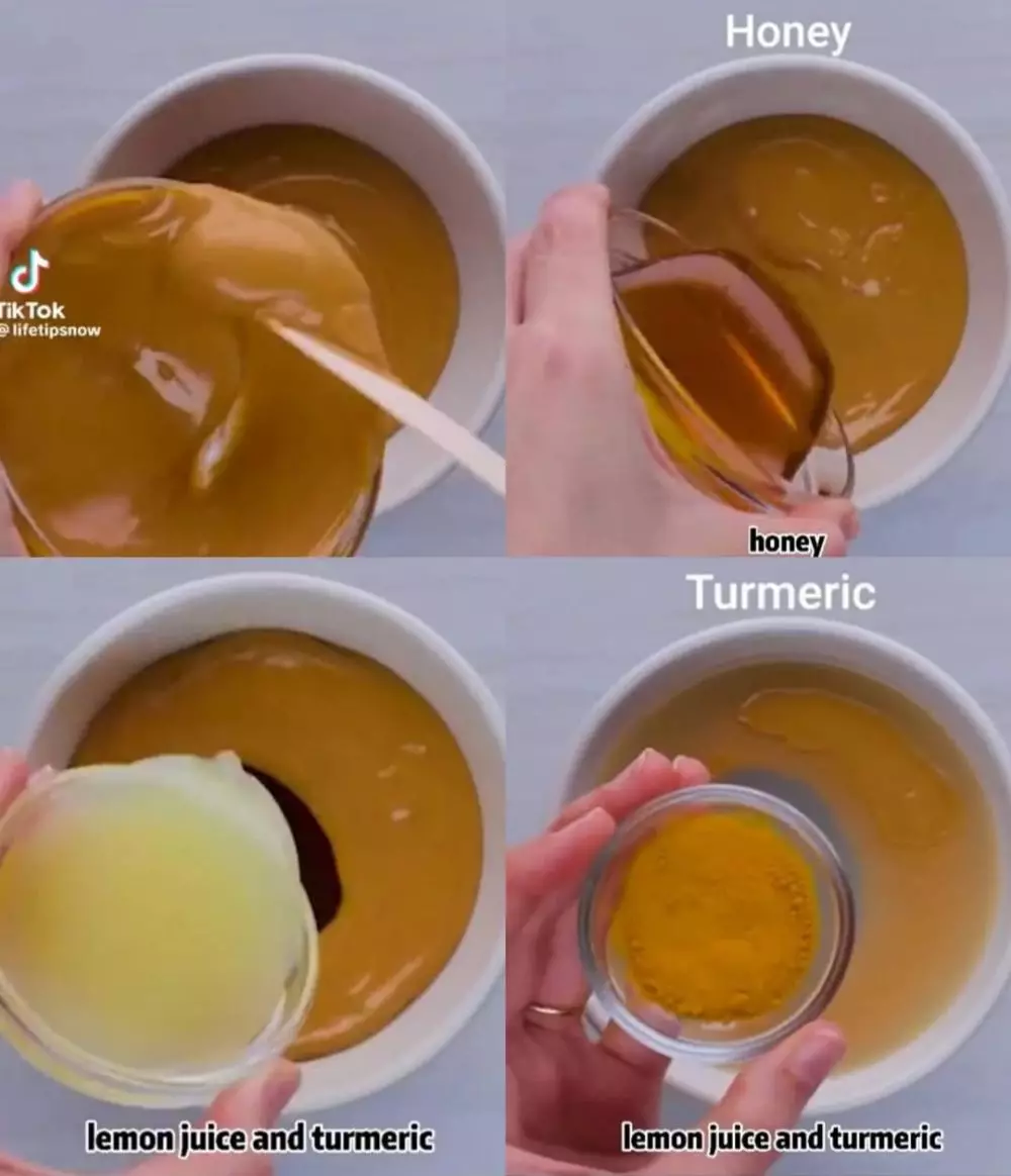 lutut kasar dan gelap © TikTok