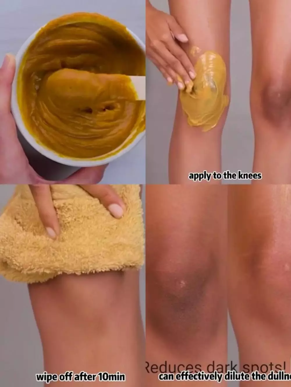 lutut kasar dan gelap © TikTok