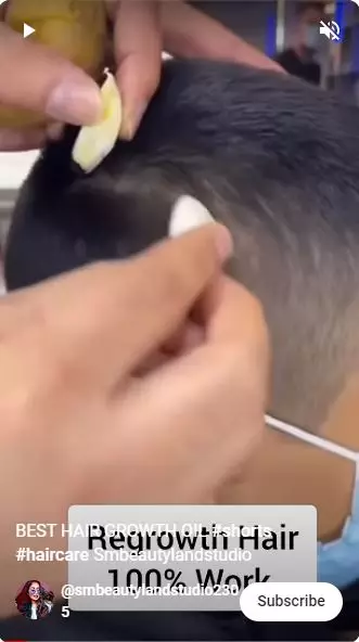 cara simpel menumbuhkan rambut pitak pinggir berbagai sumber