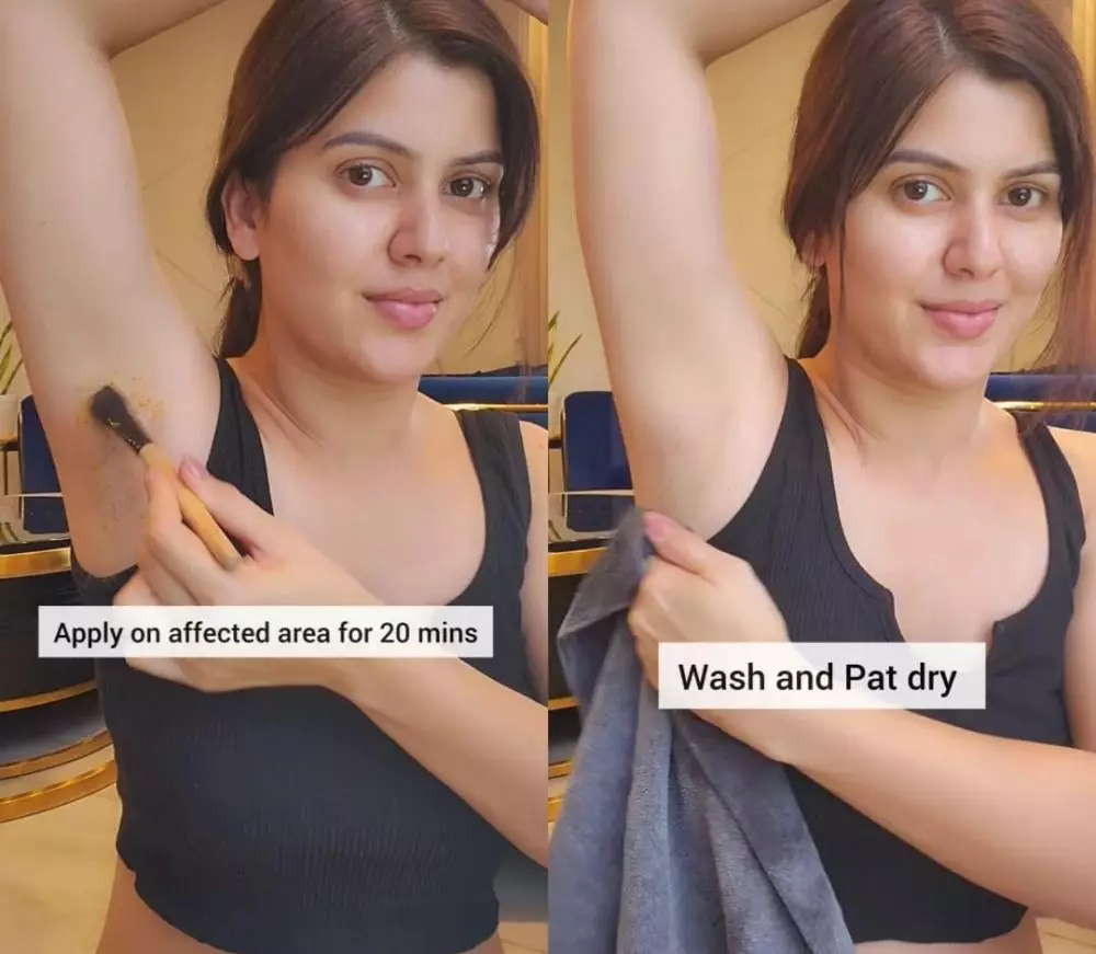 cerahkan ketiak gelap © Instagram