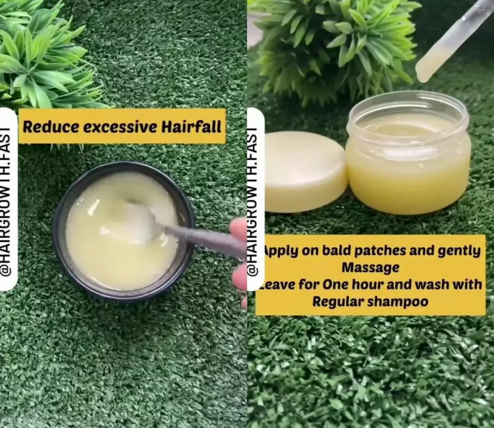 kebotakan wajib coba © Instagram