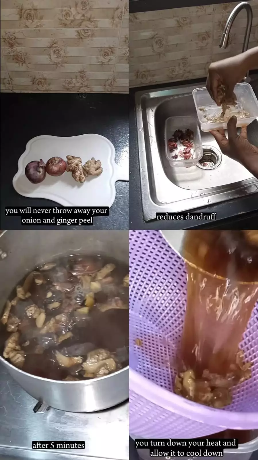 kerontokan dan ketombe © Instagram