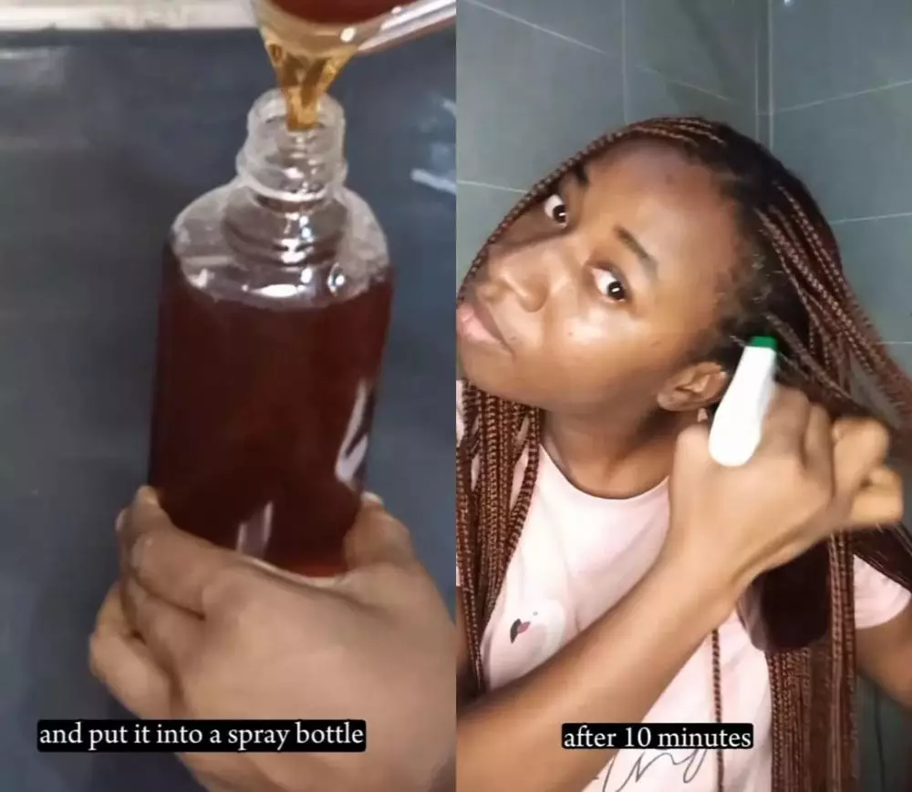 kerontokan dan ketombe © Instagram