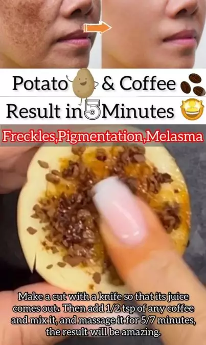 Trik atasi noda hiperpigmentasi wajah pakai 1 jenis umbi-umbian Berbagai sumber