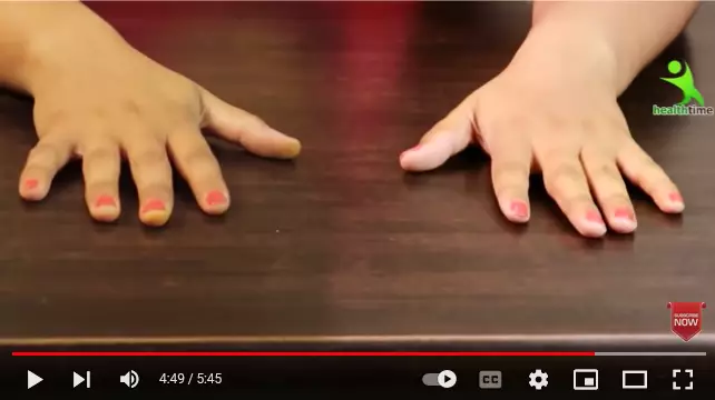 trik atasi belang pada tangan pakai 1 bahan dapur berbagai sumber