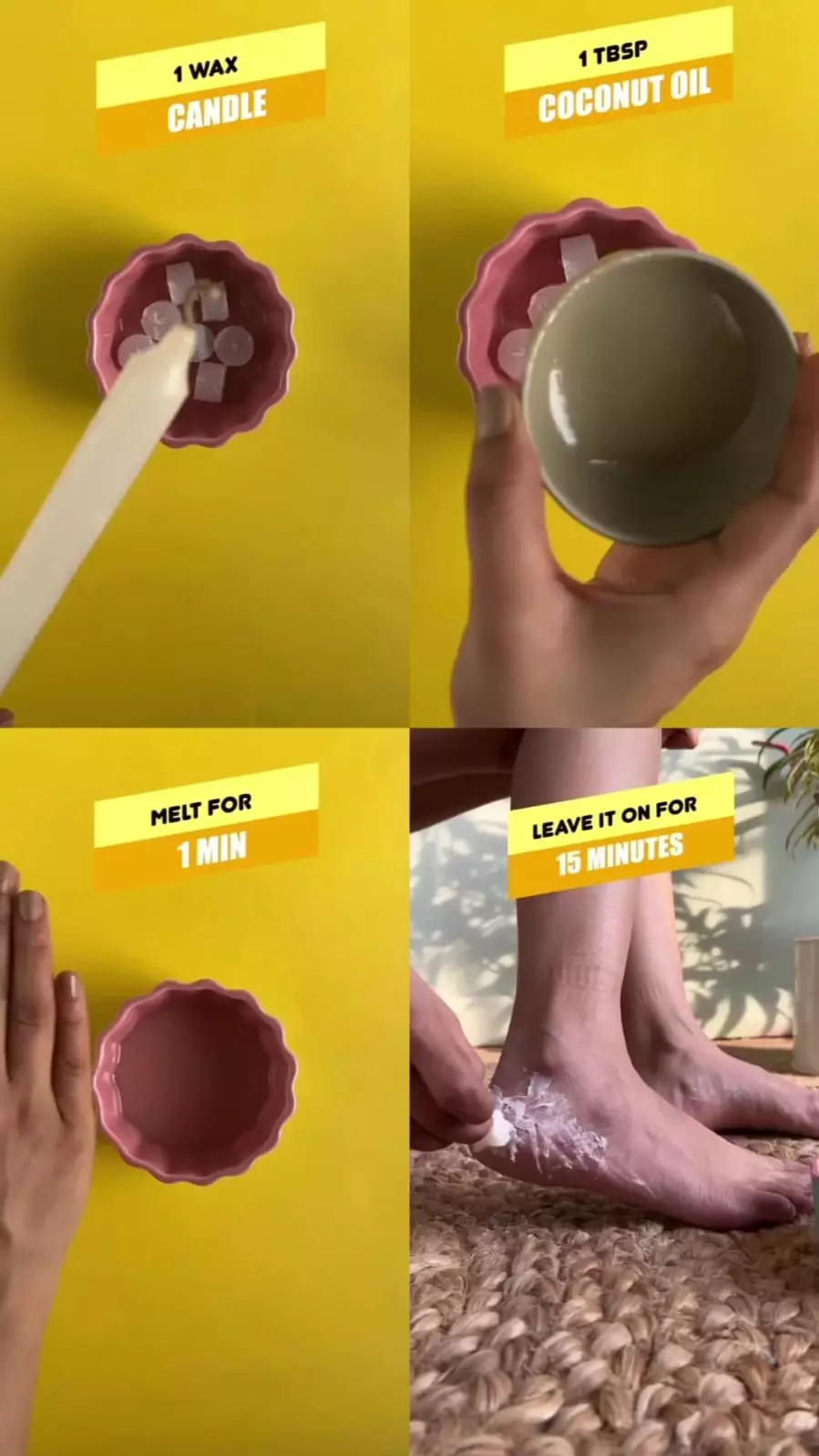 tumit kaki yang pecah © Instagram