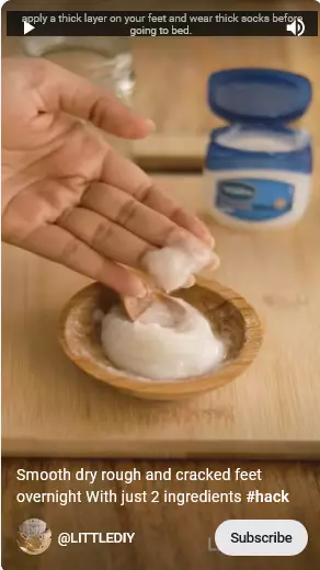 trik atasi kulit kering di sela jari kaki berbagai sumber