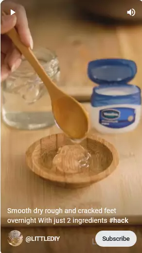 trik atasi kulit kering di sela jari kaki berbagai sumber