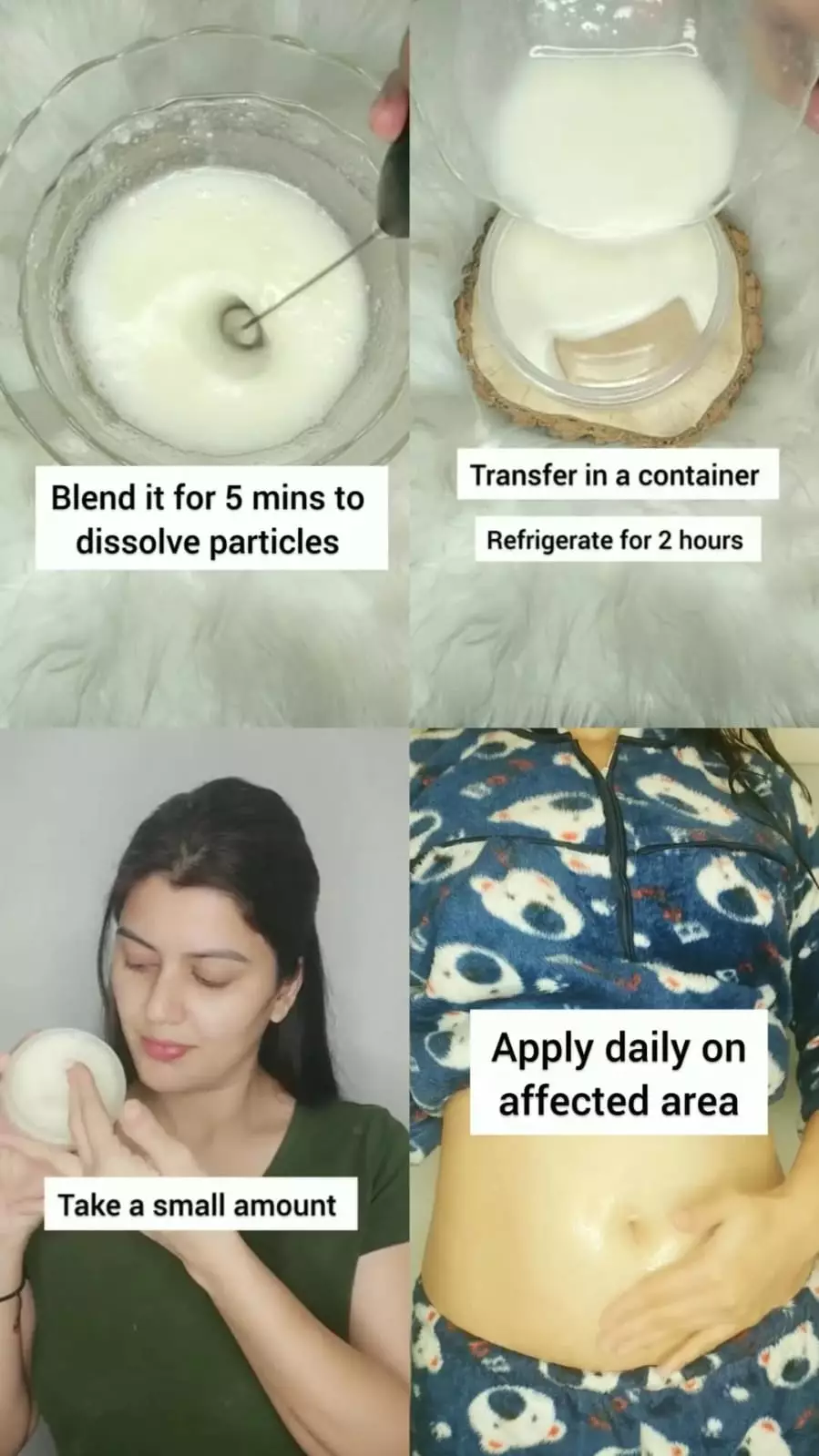 Trik pudarkan stretch marks © Instagram