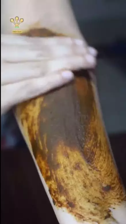 cara menghilangkan kulit belang di area lengan atas berbagai sumber cara menghilangkan kulit belang di area lengan atas berbagai sumber