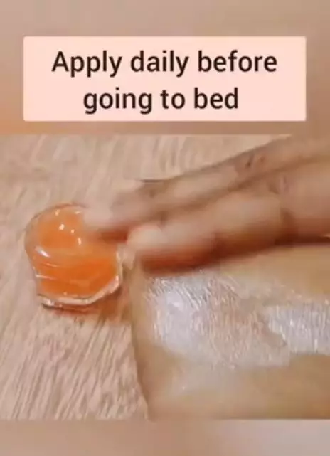 Night cream untuk flek hitam pakai 1 jenis buah Berbagai sumber Night cream untuk flek hitam pakai 1 jenis buah Berbagai sumber