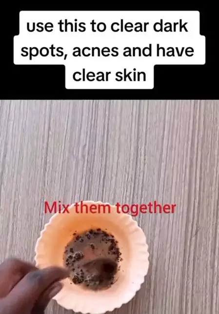 Hilangkan flek hitam membandel pakai 1 bahan pemanis Berbagai sumber Hilangkan flek hitam membandel pakai 1 bahan pemanis Berbagai sumber