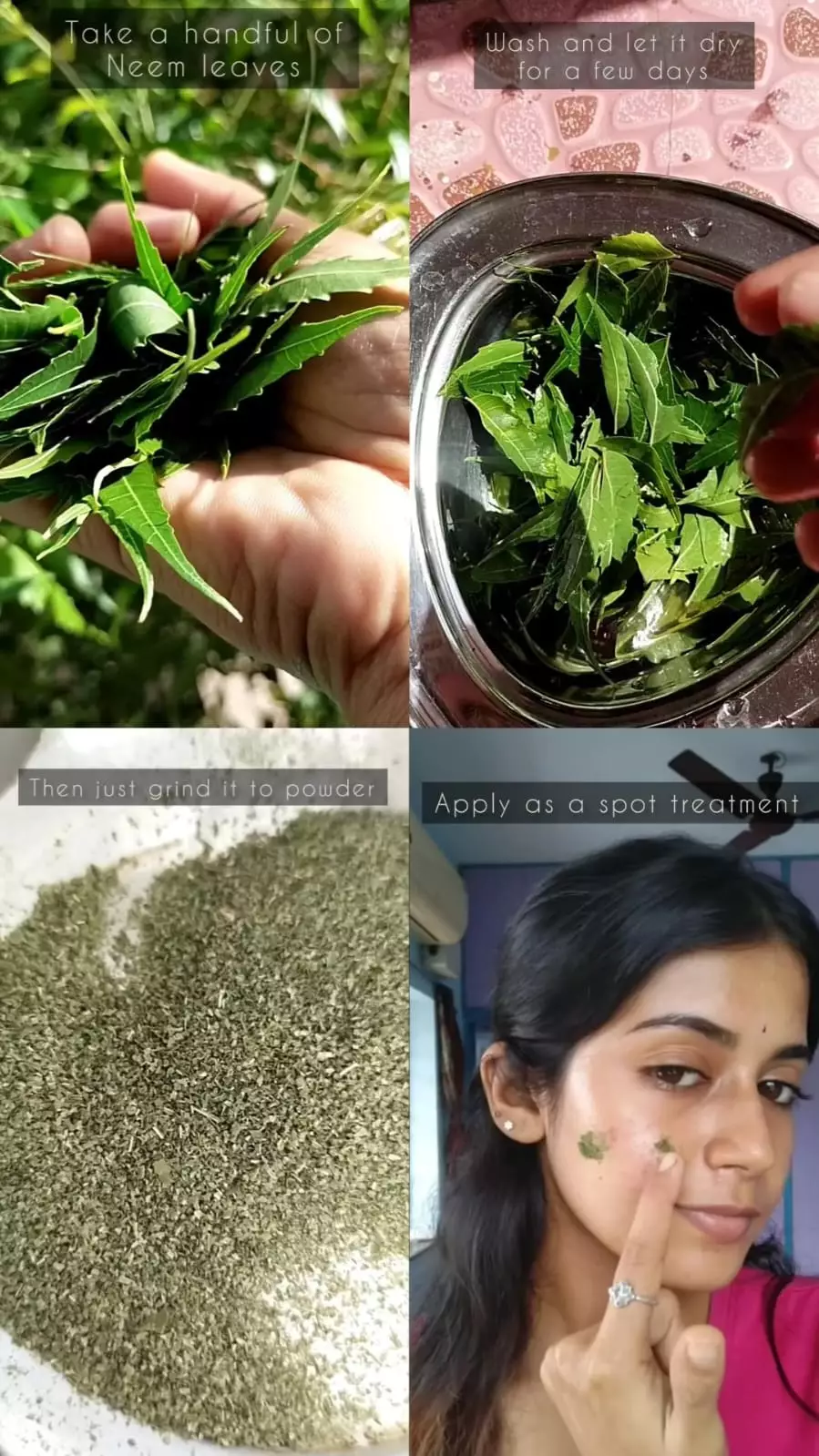 jerawat bengkak dan meradang kempes © Instagram