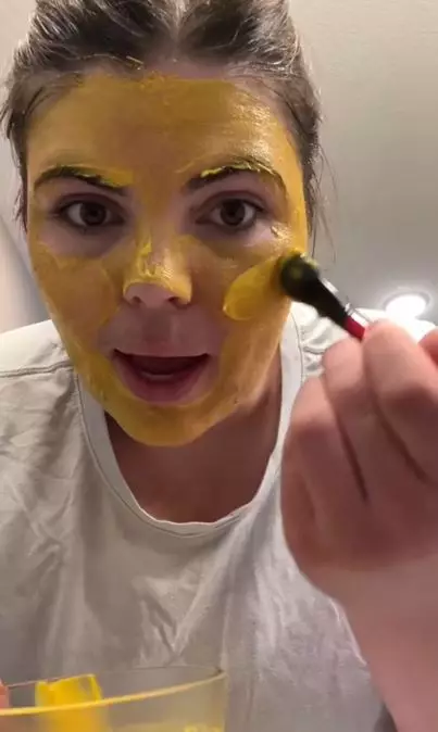 Redakan kemerahan jerawat pakai 1 jenis rempah Berbagai sumber Redakan kemerahan jerawat pakai 1 jenis rempah Berbagai sumber