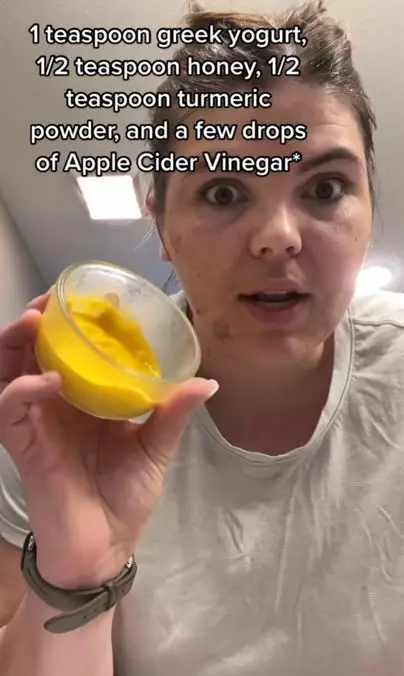 Redakan kemerahan jerawat pakai 1 jenis rempah Berbagai sumber Redakan kemerahan jerawat pakai 1 jenis rempah Berbagai sumber