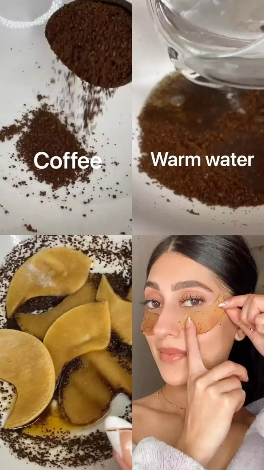 kerutan hitam di bawah mata © Instagram kerutan hitam di bawah mata © Instagram