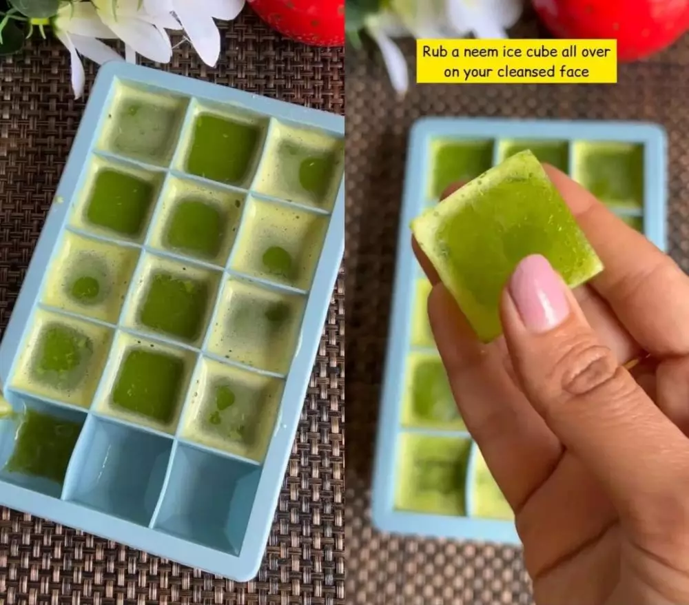 hilangkan jerawat agar tidak berbekas © Instagram