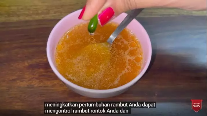 cara atasi kebotakan koin hanya pakai hair serum berbagai sumber cara atasi kebotakan koin hanya pakai hair serum berbagai sumber
