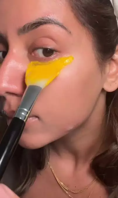 Atasi dark circle dan kantung mata pakai 1 bahan pemanis Berbagai sumber Atasi dark circle dan kantung mata pakai 1 bahan pemanis Berbagai sumber