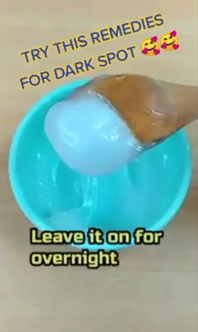 Pudarkan flek hitam pakai krim malam dari 1 jenis minyak Berbagai sumber Pudarkan flek hitam pakai krim malam dari 1 jenis minyak Berbagai sumber