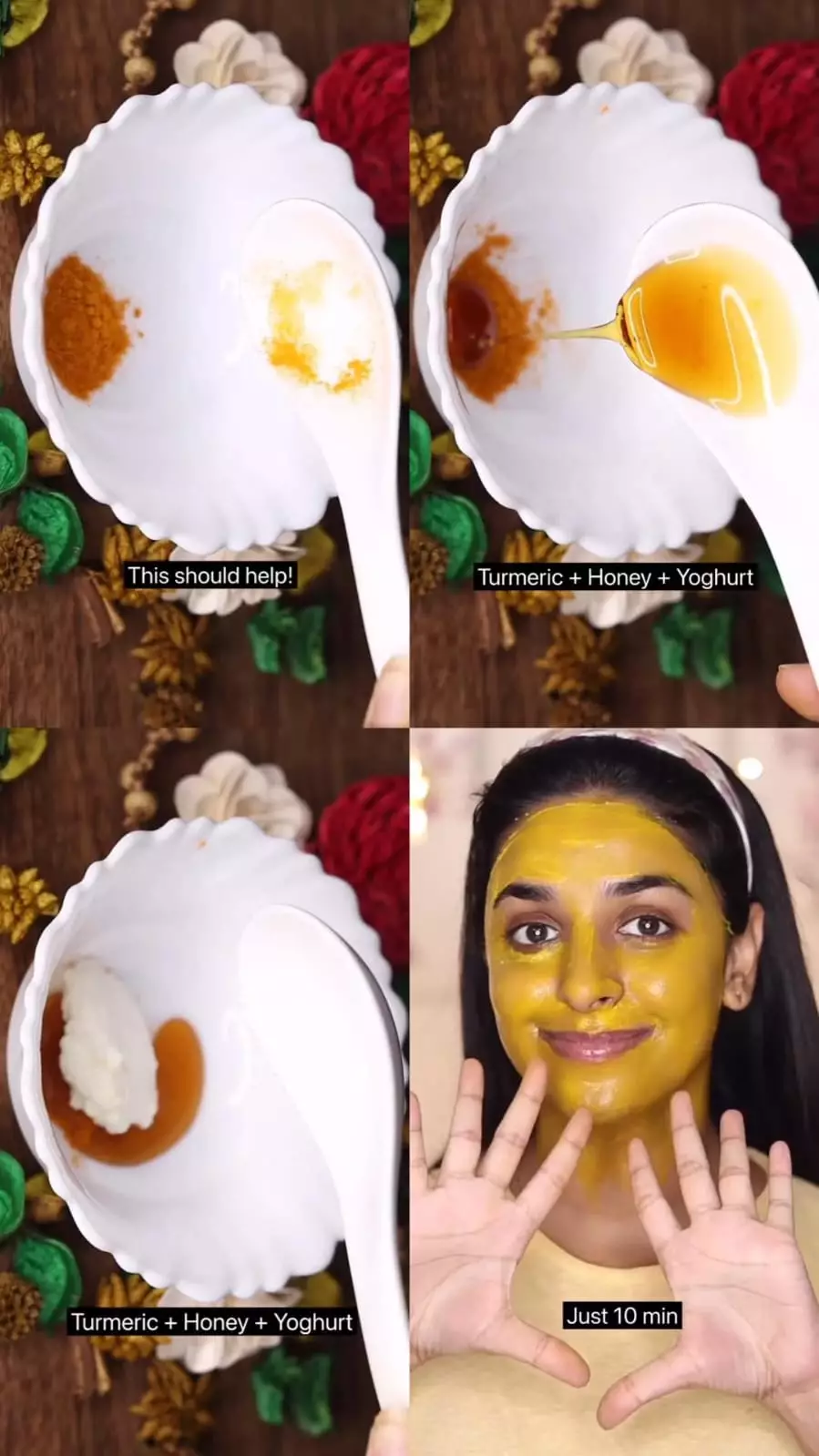 kulit belang kembali bersinar merata © Instagram kulit belang kembali bersinar merata © Instagram