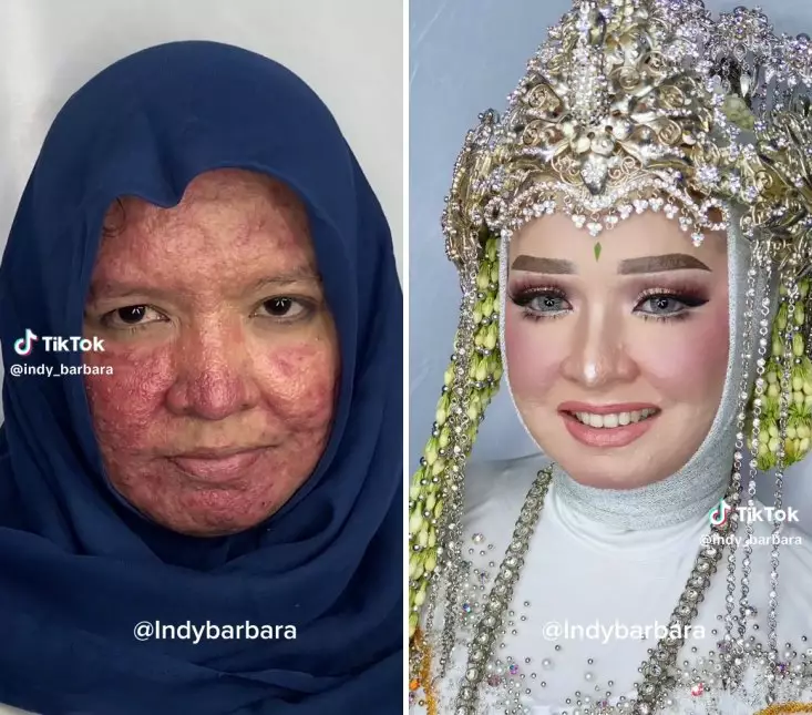 makeup jerawat parah © TikTok makeup jerawat parah © TikTok
