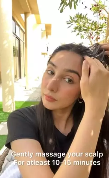 Tumbuhkan rambut pitak pakai 1 jenis produk olahan susu Berbagai sumber