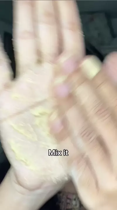 cara mencerahkan bekas luka berbagai sumber