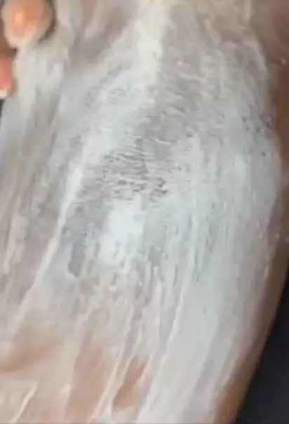 Memutihkan siku hitam pakai 1 produk pembersih gigi Berbagai sumber