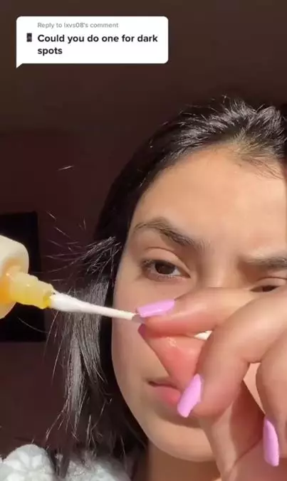 Hilangkan flek hitam dengan 1 jenis minyak esensial Berbagai sumber