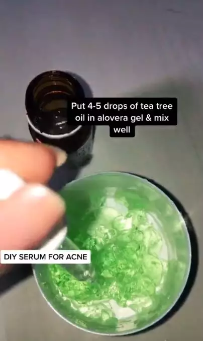 Sembuhkan jerawat meradang pakai 1 jenis minyak esensial Berbagai sumber