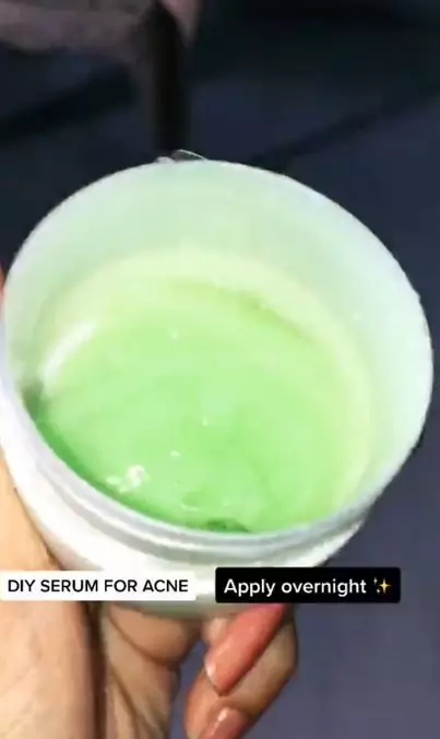 Sembuhkan jerawat meradang pakai 1 jenis minyak esensial Berbagai sumber